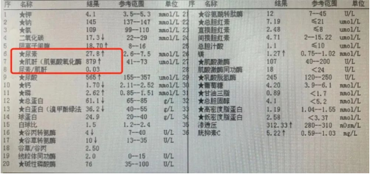 精神科从医近20年发现有一类药物长期服用危害性很大趁早远离