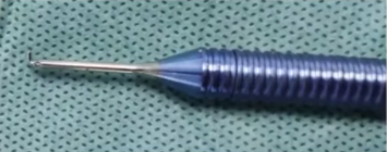 白内障注吸器怎么使用白内障超声乳化手术I／A注吸皮质、抛光及人工晶体植入技术_https://www.jmylbn.com_新闻资讯_第2张