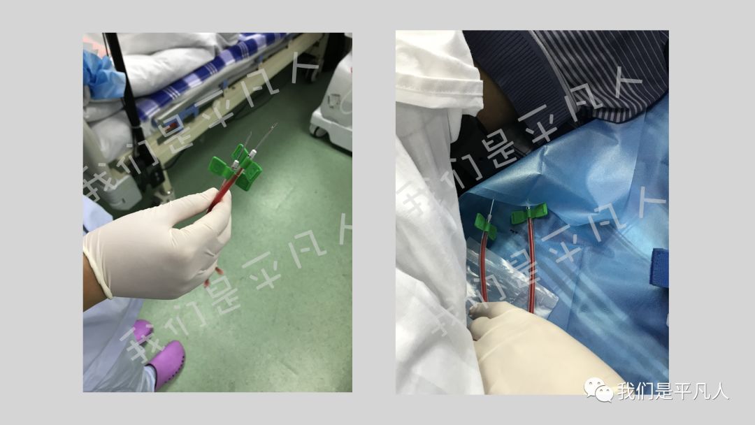 穿刺针怎么用透析护士｜使用后的透析用穿刺针，应如何处理呢？_https://www.jmylbn.com_新闻资讯_第17张