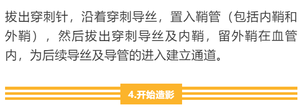 【干货】支架介入手术图文直播