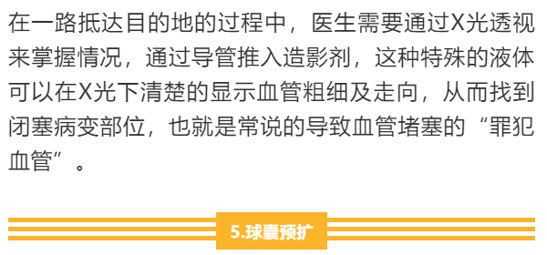 【干货】支架介入手术图文直播