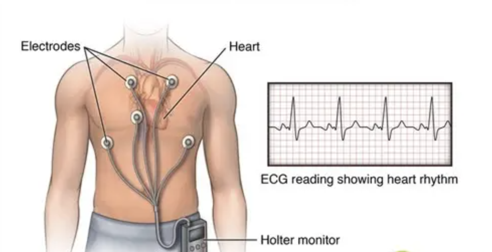 心电图检测仪怎么用【索思科研一线】可穿戴式实时心电监测仪与传统动态心电图在日常居家监测时的对比研究_https://www.jmylbn.com_新闻资讯_第5张