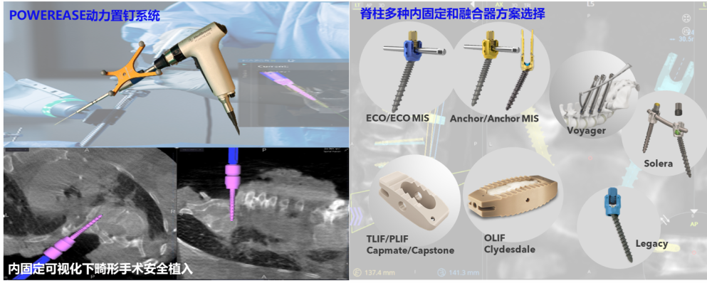 《脊智领航》|