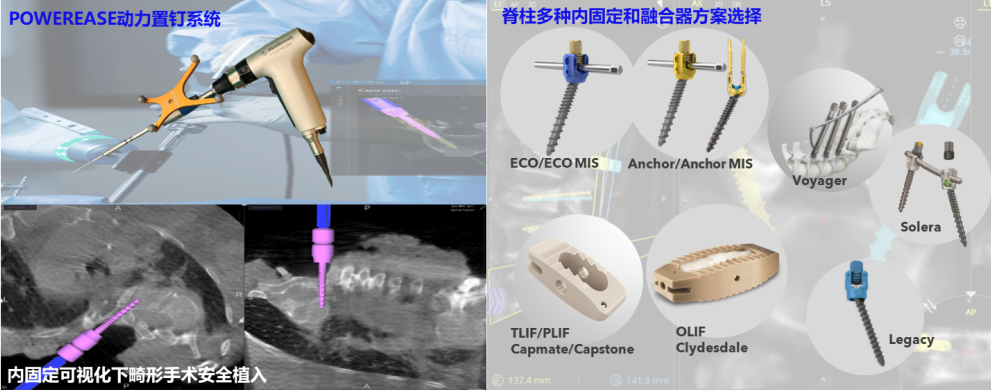 《脊智领航》|