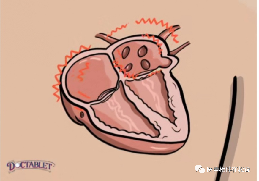 甲亢脖子和正常脖子图片_甲亢突眼正常图片_女性甲亢早期脖子两侧图片