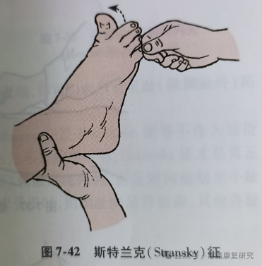 叩诊锤的怎么用康复必备：41个常见的神经反射检查_https://www.jmylbn.com_新闻资讯_第41张