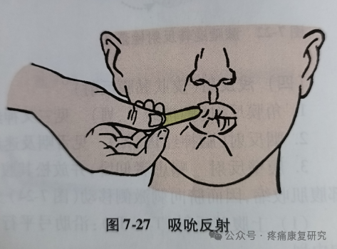 叩诊锤的怎么用康复必备：41个常见的神经反射检查_https://www.jmylbn.com_新闻资讯_第26张