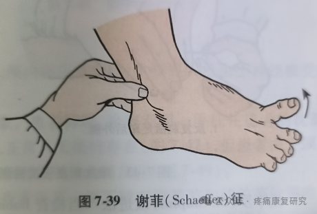 叩诊锤的怎么用康复必备：41个常见的神经反射检查_https://www.jmylbn.com_新闻资讯_第38张