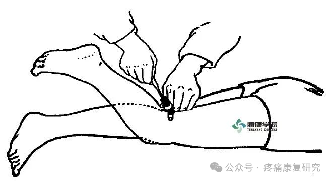 叩诊锤的怎么用康复必备：41个常见的神经反射检查_https://www.jmylbn.com_新闻资讯_第11张