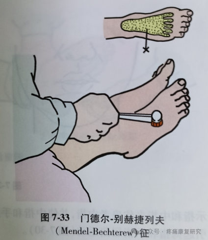 叩诊锤的怎么用康复必备：41个常见的神经反射检查_https://www.jmylbn.com_新闻资讯_第32张