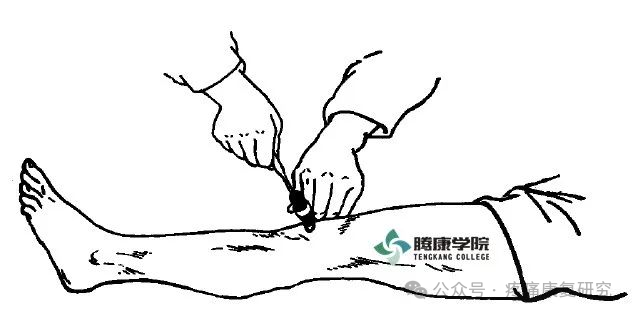 叩诊锤的怎么用康复必备：41个常见的神经反射检查_https://www.jmylbn.com_新闻资讯_第10张