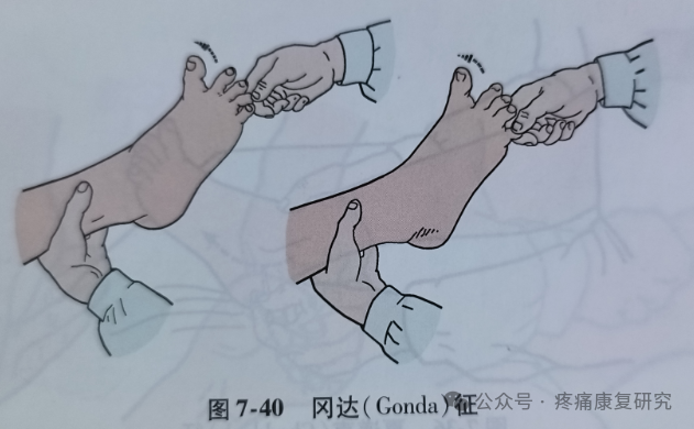 叩诊锤的怎么用康复必备：41个常见的神经反射检查_https://www.jmylbn.com_新闻资讯_第39张