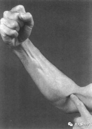 肱二头肌和肱肌_喙肱肌_肱桡肌