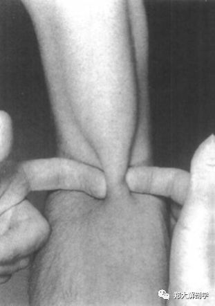 喙肱肌_肱桡肌_肱二头肌和肱肌