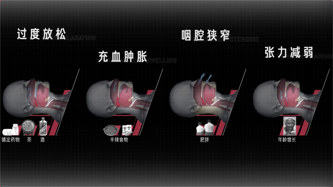 Vol 163 打呼噜到底有多危险丨视频文字稿 回形针paperclip 微信公众号文章阅读 Wemp