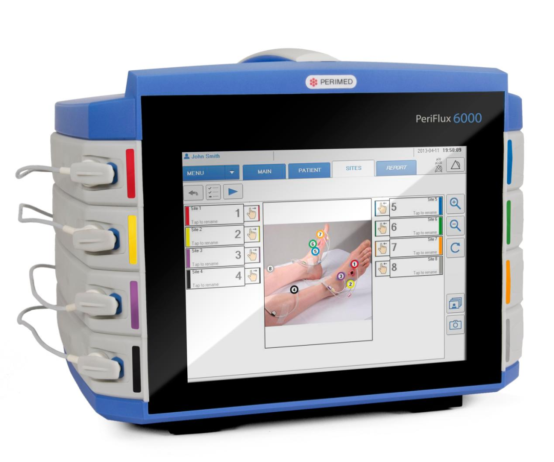 什么是经皮氧分压健康科普丨糖尿病足防治新利器---经皮氧分压检测_https://www.jmylbn.com_新闻资讯_第8张