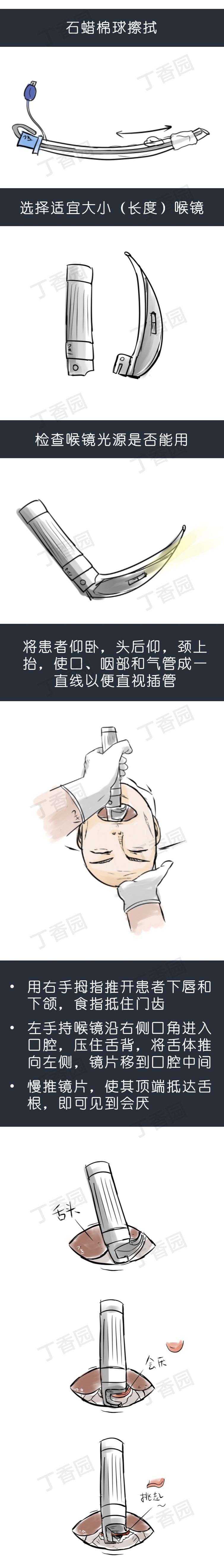 气管插管牙垫怎么放【急救】院前急救之经口气管插管术_https://www.jmylbn.com_新闻资讯_第18张