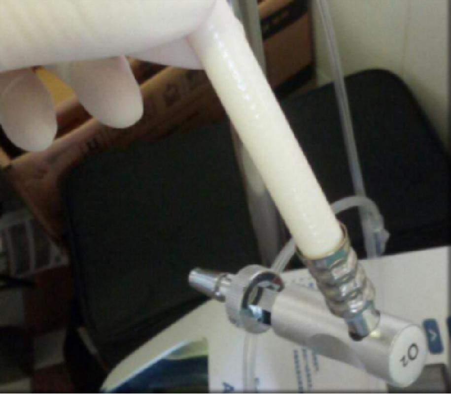 呼吸机怎么换氧气患者使用呼吸机后血氧为何更低了？一文解答_https://www.jmylbn.com_新闻资讯_第3张