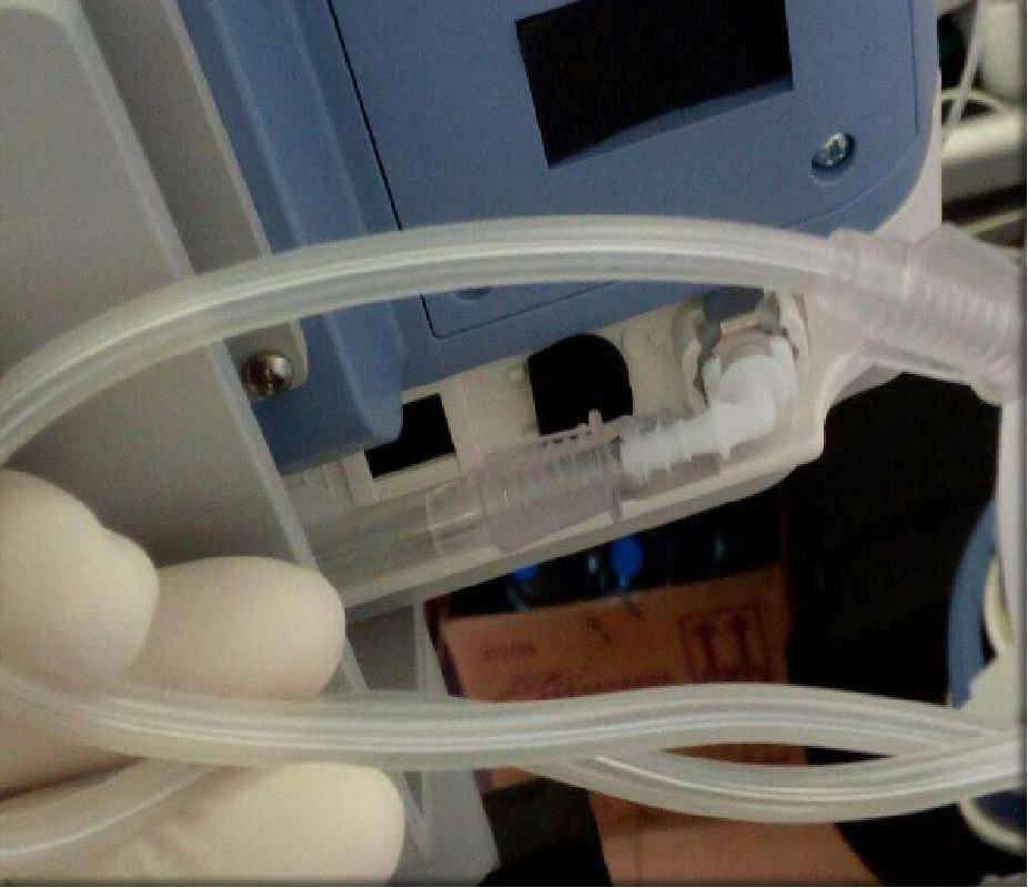 呼吸机怎么换氧气患者使用呼吸机后血氧为何更低了？一文解答_https://www.jmylbn.com_新闻资讯_第4张