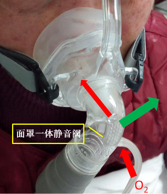呼吸机怎么换氧气患者使用呼吸机后血氧为何更低了？一文解答_https://www.jmylbn.com_新闻资讯_第5张