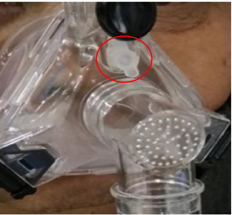 制氧机面罩怎么用普通面罩和储氧面罩有何区别？关于「面罩和氧疗」的 5 问 5 答_https://www.jmylbn.com_新闻资讯_第7张