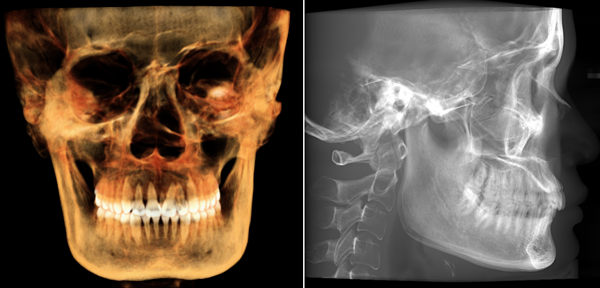 口腔设备有什么一文读懂 ｜ 口腔影像设备大科普，哪种才是最适合你的选择？_https://www.jmylbn.com_新闻资讯_第13张