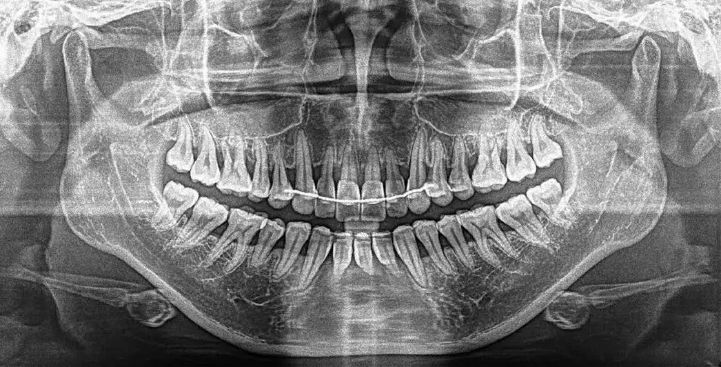口腔设备有什么一文读懂 ｜ 口腔影像设备大科普，哪种才是最适合你的选择？_https://www.jmylbn.com_新闻资讯_第8张