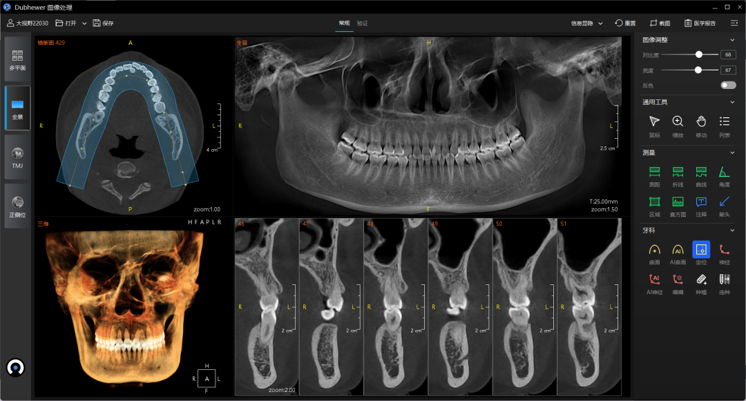 口腔设备有什么一文读懂 ｜ 口腔影像设备大科普，哪种才是最适合你的选择？_https://www.jmylbn.com_新闻资讯_第14张