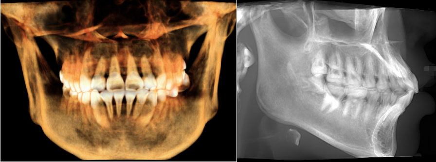 口腔设备有什么一文读懂 ｜ 口腔影像设备大科普，哪种才是最适合你的选择？_https://www.jmylbn.com_新闻资讯_第12张