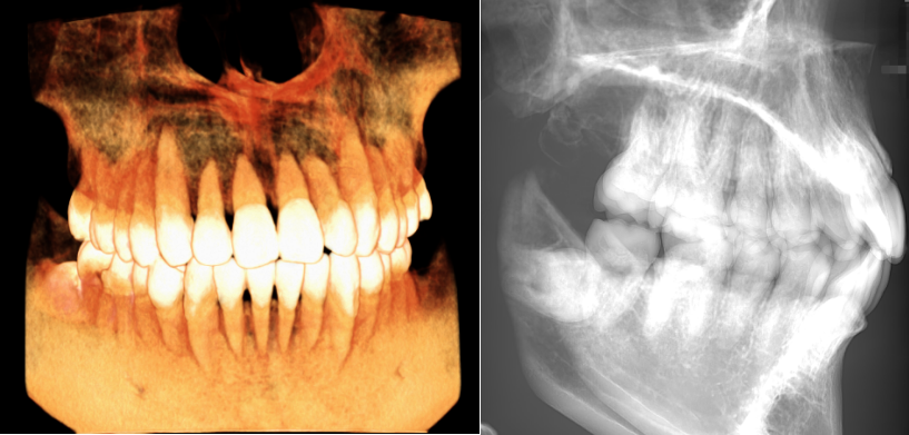 口腔设备有什么一文读懂 ｜ 口腔影像设备大科普，哪种才是最适合你的选择？_https://www.jmylbn.com_新闻资讯_第11张