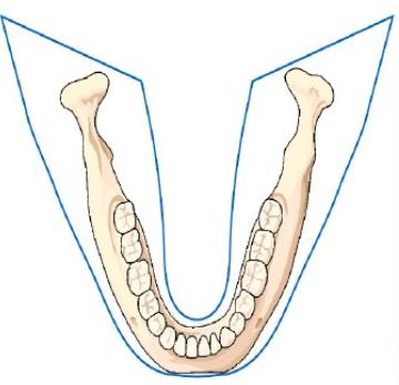 口腔设备有什么一文读懂 ｜ 口腔影像设备大科普，哪种才是最适合你的选择？_https://www.jmylbn.com_新闻资讯_第7张