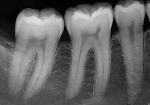 口腔设备有什么一文读懂 ｜ 口腔影像设备大科普，哪种才是最适合你的选择？_https://www.jmylbn.com_新闻资讯_第5张
