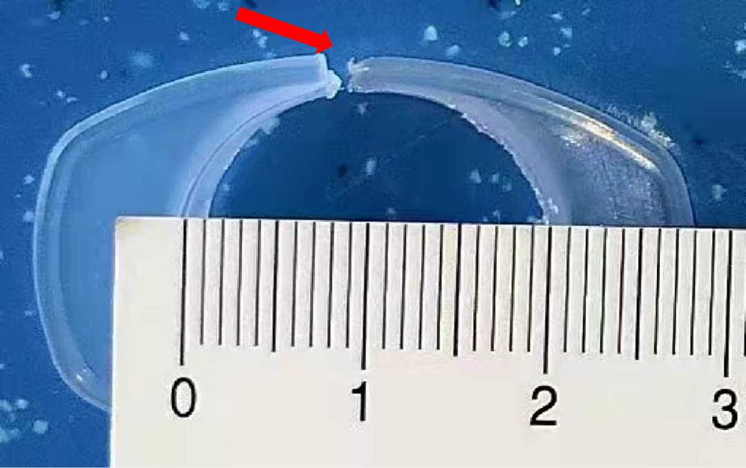 为什么20ml针筒的针在边上输液港不知道如何穿刺？扎针神器来了_https://www.jmylbn.com_新闻资讯_第4张