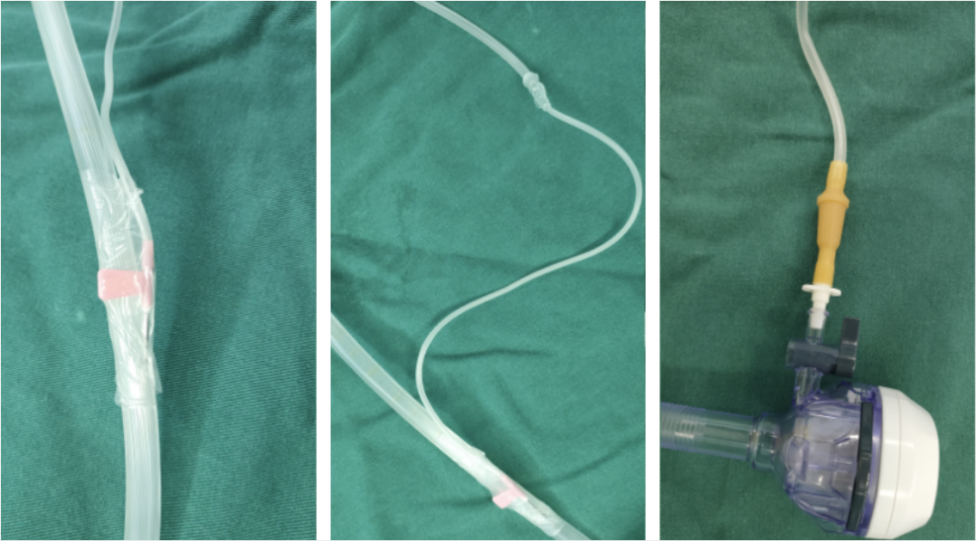 吸引器用什么手术室烟雾泛滥！！给大家介绍几款排烟神器_https://www.jmylbn.com_新闻资讯_第4张