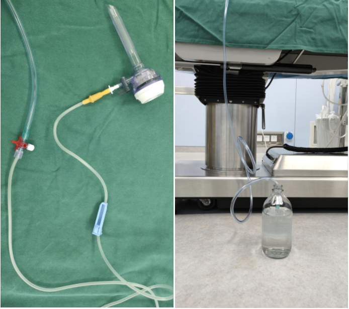 吸引器用什么手术室烟雾泛滥！！给大家介绍几款排烟神器_https://www.jmylbn.com_新闻资讯_第9张