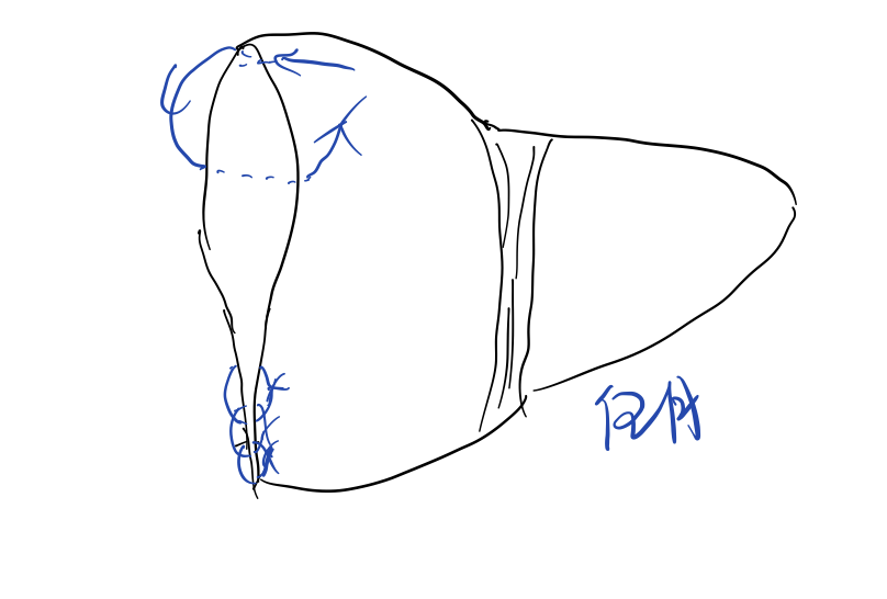 缝伤口怎么打结急诊外科必备技能——清创缝合术_https://www.jmylbn.com_新闻资讯_第9张