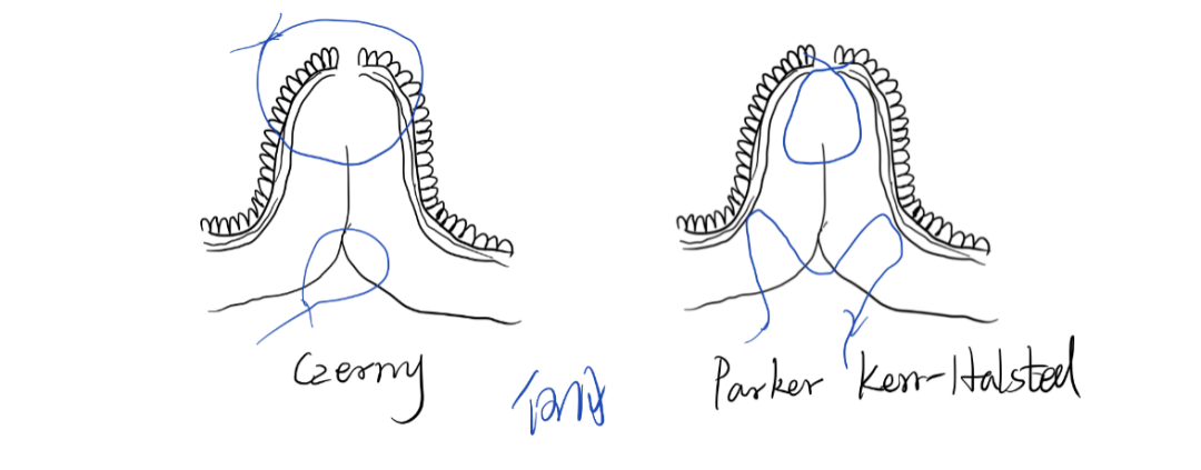 缝伤口怎么打结急诊外科必备技能——清创缝合术_https://www.jmylbn.com_新闻资讯_第13张