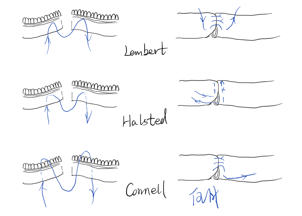 缝伤口怎么打结急诊外科必备技能——清创缝合术_https://www.jmylbn.com_新闻资讯_第12张