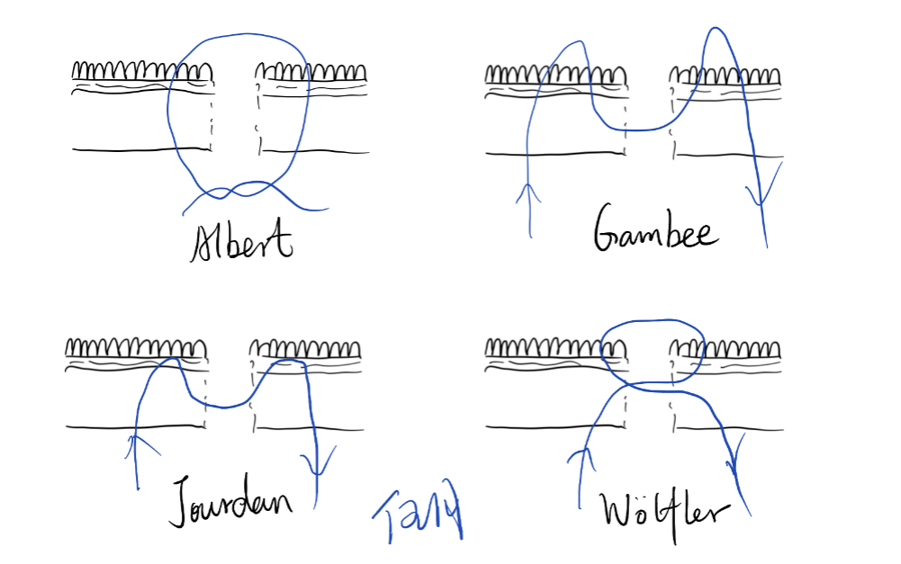 缝伤口怎么打结急诊外科必备技能——清创缝合术_https://www.jmylbn.com_新闻资讯_第14张