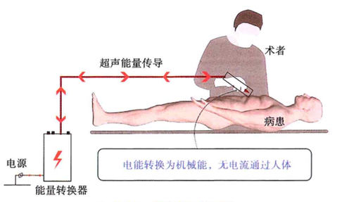 为什么要手术电刀笔手术室笔记：单极、双极、超声刀、氩气刀对比，收好这份「兵器谱」_https://www.jmylbn.com_新闻资讯_第6张