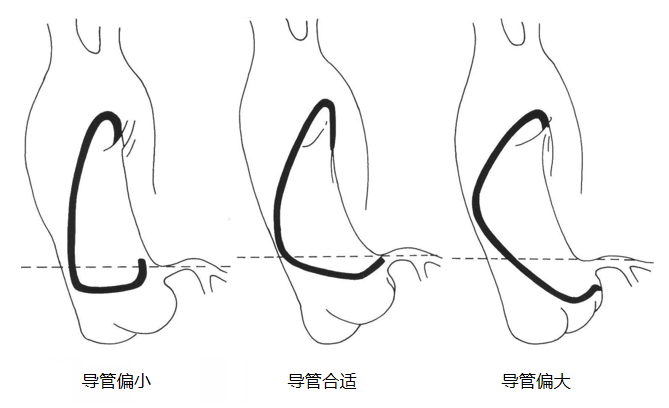 介入导管有哪些型号早读 ｜ 冠脉介入离不开的导管，你需要这篇文章！_https://www.jmylbn.com_新闻资讯_第16张