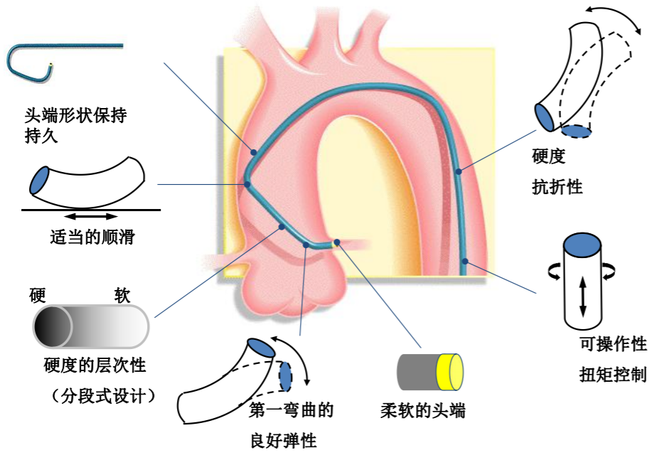 介入导管有哪些型号早读 ｜ 冠脉介入离不开的导管，你需要这篇文章！_https://www.jmylbn.com_新闻资讯_第35张