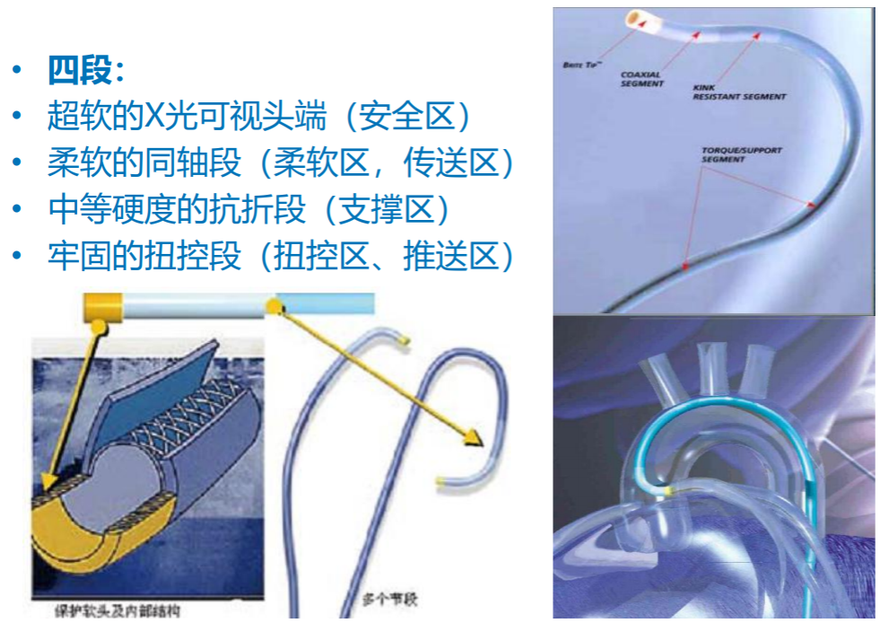 介入导管有哪些型号早读 ｜ 冠脉介入离不开的导管，你需要这篇文章！_https://www.jmylbn.com_新闻资讯_第23张