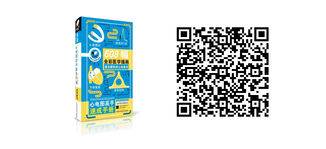 床旁心电图怎么做预售 ｜ 床旁临时心脏起搏手册，手把手教会起搏技术！_https://www.jmylbn.com_新闻资讯_第39张