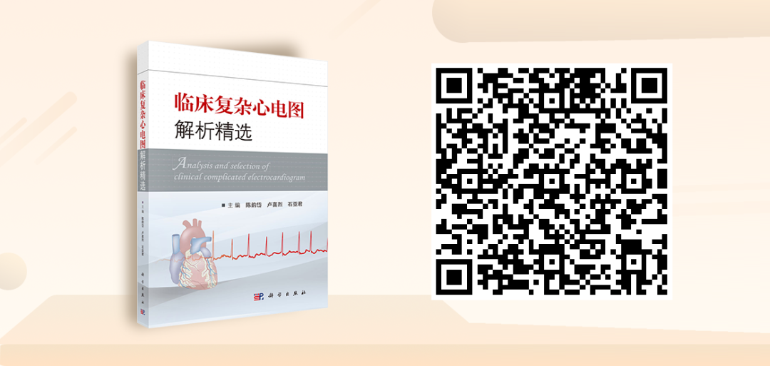 床旁心电图怎么做预售 ｜ 床旁临时心脏起搏手册，手把手教会起搏技术！_https://www.jmylbn.com_新闻资讯_第34张