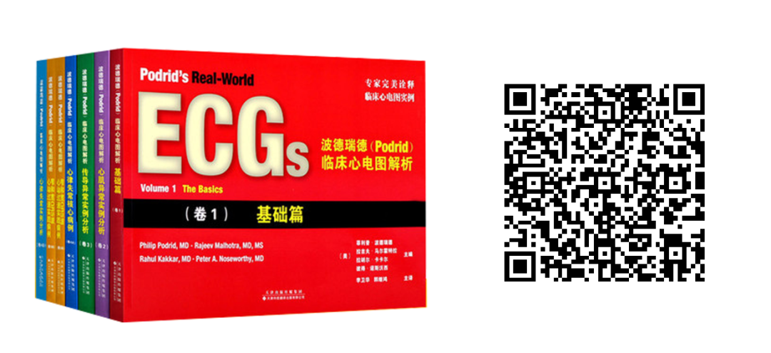 床旁心电图怎么做预售 ｜ 床旁临时心脏起搏手册，手把手教会起搏技术！_https://www.jmylbn.com_新闻资讯_第41张