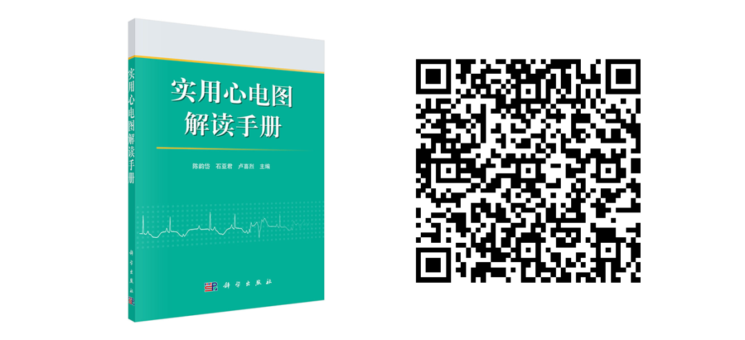 床旁心电图怎么做预售 ｜ 床旁临时心脏起搏手册，手把手教会起搏技术！_https://www.jmylbn.com_新闻资讯_第45张