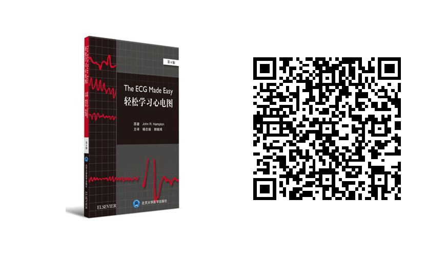 床旁心电图怎么做预售 ｜ 床旁临时心脏起搏手册，手把手教会起搏技术！_https://www.jmylbn.com_新闻资讯_第46张