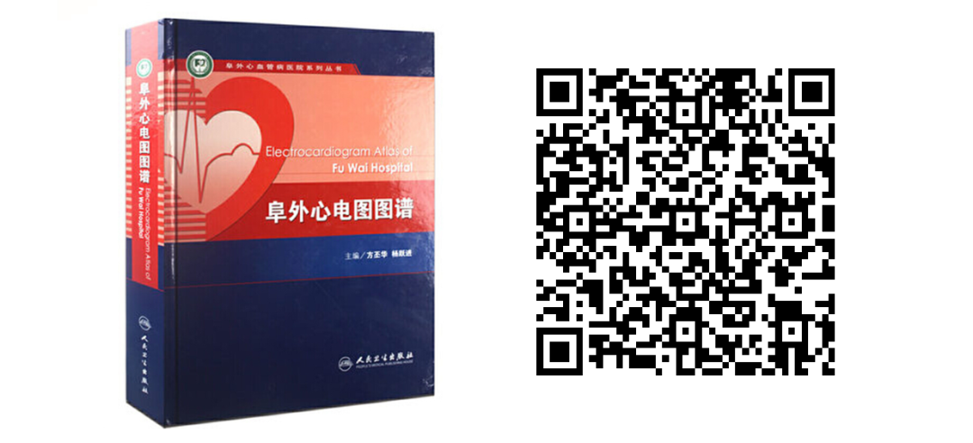 床旁心电图怎么做预售 ｜ 床旁临时心脏起搏手册，手把手教会起搏技术！_https://www.jmylbn.com_新闻资讯_第43张