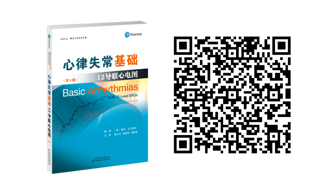 床旁心电图怎么做预售 ｜ 床旁临时心脏起搏手册，手把手教会起搏技术！_https://www.jmylbn.com_新闻资讯_第28张
